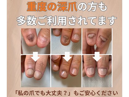 リネイル 川越(Re:NAIL)の写真