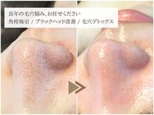 レイテノール 藤沢店