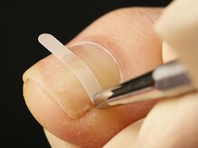 快歩堂フットケアセンター 日本橋館/爪のケア