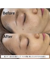 ウルル(ULuLu)/ビフォーアフター