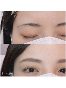 レディフル(Ladyful)/お顔の印象が変わります