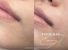 ワクシングトウキョウ アイス 池袋(waxing tokyo ice)/フェイシャルワックス