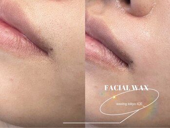 ワクシングトウキョウ アイス 池袋(waxing tokyo ice)/フェイシャルワックス