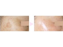 ノンノン(NonNon)/若々しい見た目へ