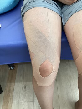 おなが浦添当山整骨院/膝テーピング