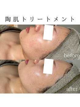 ビューティービューティー(BEAUTY BEAUTY)/