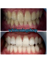 ホワイトニングショップ 倉敷店/