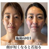 かたりべ