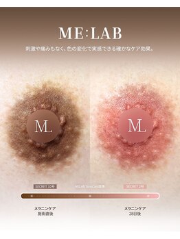 ユーエステティック(U AESTHETIC)/[敏感肌専門]韓国皮膚科発Melab