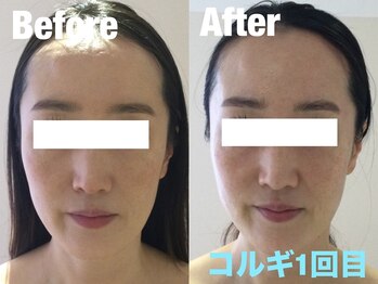 ビーキュート 学芸大学店(BE-CUTE)/コルギ1回施術 40代