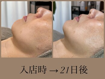 ビーエルティー(blt)/レモンボトル