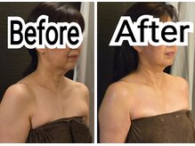 トコハナの雰囲気（【小顔&巻き肩調整50代4回施術】胸が開いてほうれい線が薄く！）