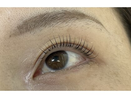 アノンズ(AnonZ)の写真