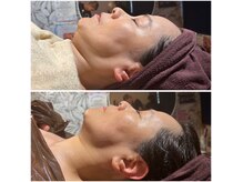 サリーエミリー 亀有店(SallyEmiry)の雰囲気（フェイスラン結果出し！レモンボトル×コルギ）