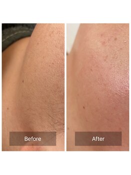 カノン(Kanon)/フェイシャルワックス