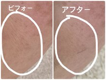 ノーブル シャット Noble Chate/やっぱり気になる頬の細かいシワ