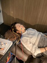 ハリステラ(HariStella)/★リフトアップ【ステラ美容鍼】