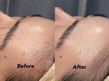 クイーン(QUEEN)/眉毛を整えて清潔感UP