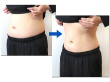 快癒舎/ポッコリお腹解消