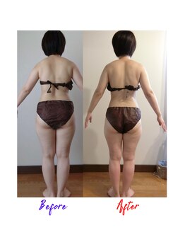 フランジパニ(Frangipani)/全身キャビコースでボディメイク