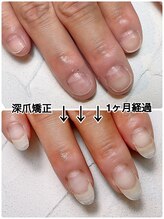 スマイルニコ(smile nico)/1ヶ月　3回ご来店でこの伸び！