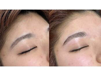 ラクーン(RACCOON)/