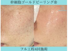リメイククリニカルビューティー(Remake clinical beauty)/お肌の内側から輝き放つ肌へ
