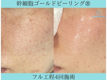 リメイククリニカルビューティー(Remake clinical beauty)/お肌の内側から輝き放つ肌へ