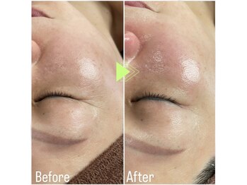 ナオ鍼灸院(Nao鍼灸院)/ラミネートした様な艶肌陶器肌へ