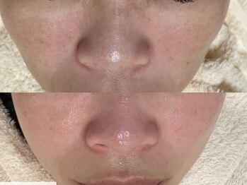 エミュ(emu)/しみケアだってお手のもの