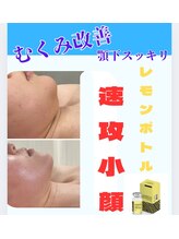 サロン叶(kanau)/レモンボトルでスッキリ小顔