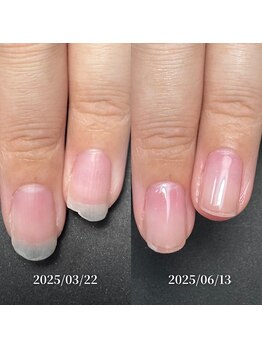 ココ(COCO)/ハンドケア・自爪育成・深爪育成