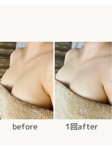 ビオラ(美ola)/施術の流れ↓