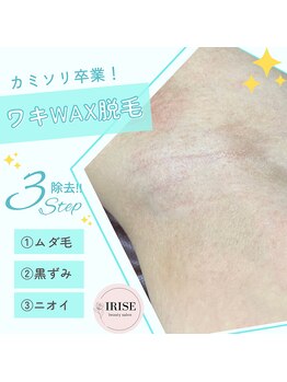 イリゼ(IRISE)/ワキWAX脱毛★キレイ３step!!