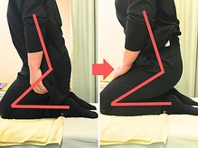 杉本接骨鍼灸院/杖が取れて歩けるようになった