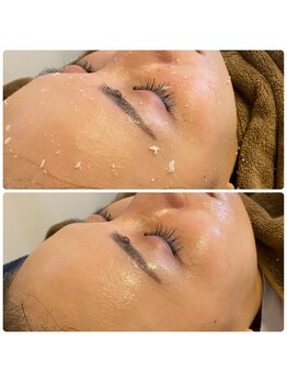 レア(Le'a)/セルマン