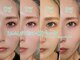 ラングル(L'ongle)の写真