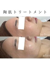 ビューティービューティー(BEAUTY BEAUTY)/