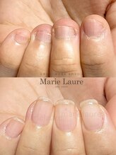 マリーロール 天王寺店(Marie Laure)/深爪矯正/自爪育成/ネイルケア