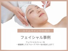 スリムライン 秋田店(The Slim Line)/before→after