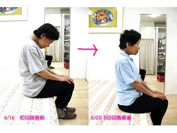 エスコート芦屋サロン/頭が落ちた！！と、来院