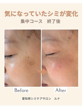 サロンルナ(Salon Luna)/40代　6回目