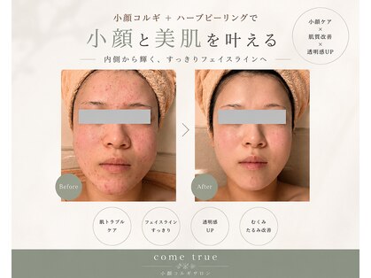 モテ肌 小顔コルギサロン カムトゥルー(come true)の写真