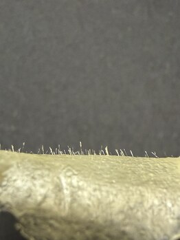 アルマ(ALMA)の写真/本気で肌質改善をしたい方へ！丁寧なカウンセリングとマツヤニワックスで垢取りをサポート◎