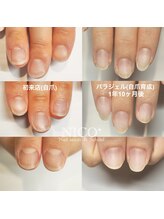 ニコプラス(NICO+)/自爪育成中