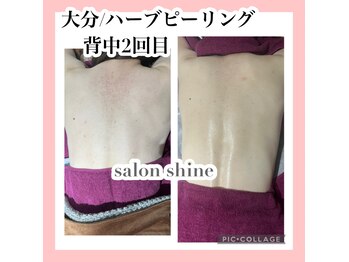 サロンシャイン(Salon Shine)