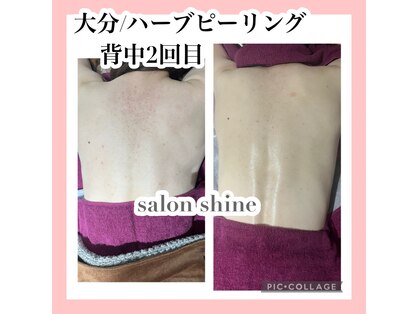 サロンシャイン(Salon Shine)の写真