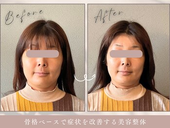ほぐし屋 かすがい/小顔リフト矯正+美姿勢整体