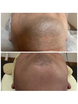 ティアレ 緑井店(Tiare)/爆抜けモード