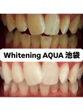 アクア 池袋店(AQUA)/ホワイトニング/池袋/東京/美白